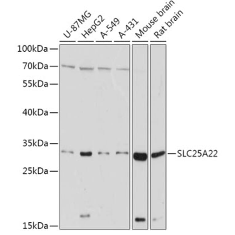 Western Blot - Anti-GC-1 Antibody (A306408) - Antibodies.com