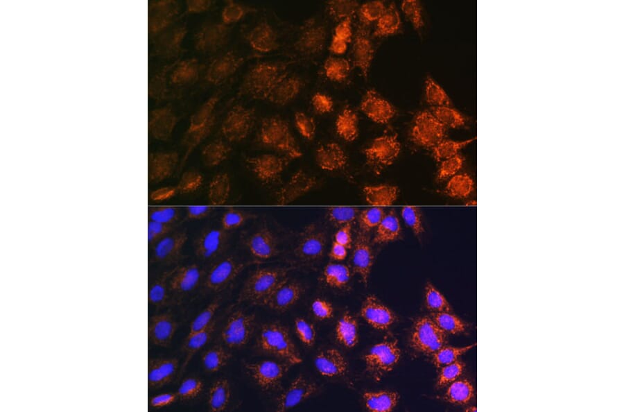 Immunofluorescence - Anti-GC-1 Antibody (A306408) - Antibodies.com