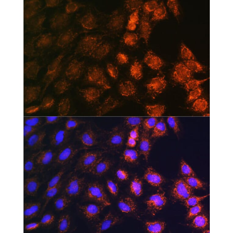 Immunofluorescence - Anti-GC-1 Antibody (A306408) - Antibodies.com