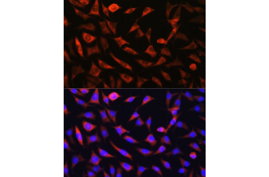 Immunofluorescence - Anti-GC-1 Antibody (A306408) - Antibodies.com