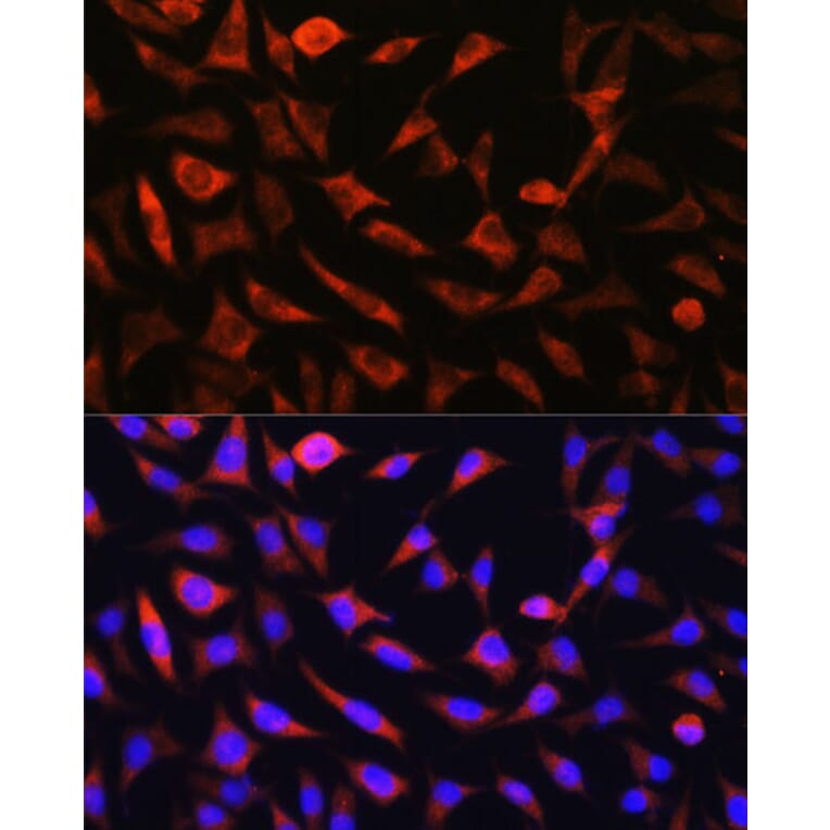Immunofluorescence - Anti-GC-1 Antibody (A306408) - Antibodies.com