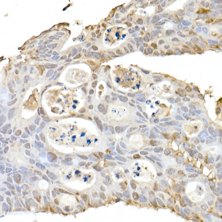 Immunohistochemistry - Anti-HSP70 Antibody (A306410) - Antibodies.com