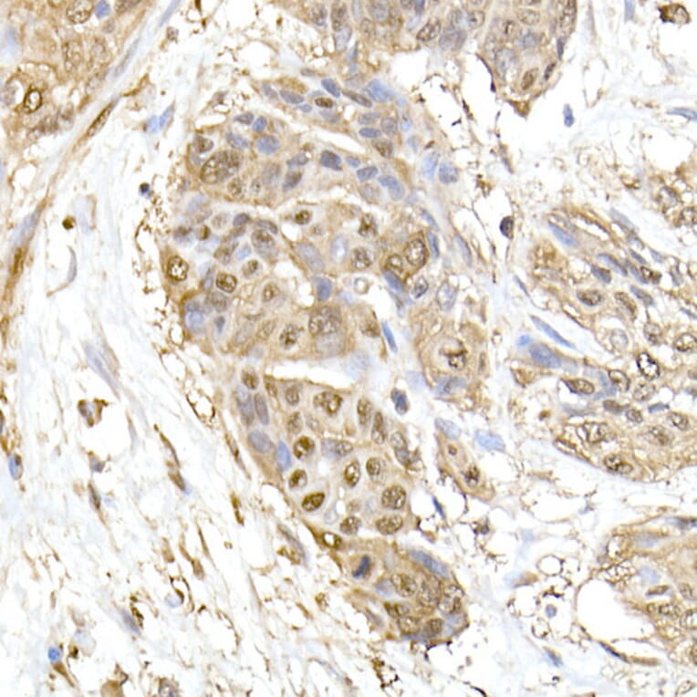 Immunohistochemistry - Anti-HSP70 Antibody (A306410) - Antibodies.com