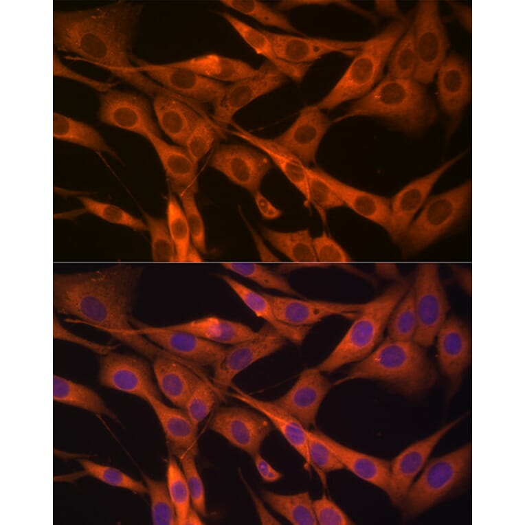 Immunofluorescence - Anti-HSP70 Antibody (A306410) - Antibodies.com