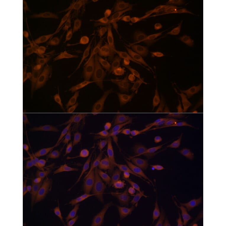 Immunofluorescence - Anti-HSP70 Antibody (A306410) - Antibodies.com