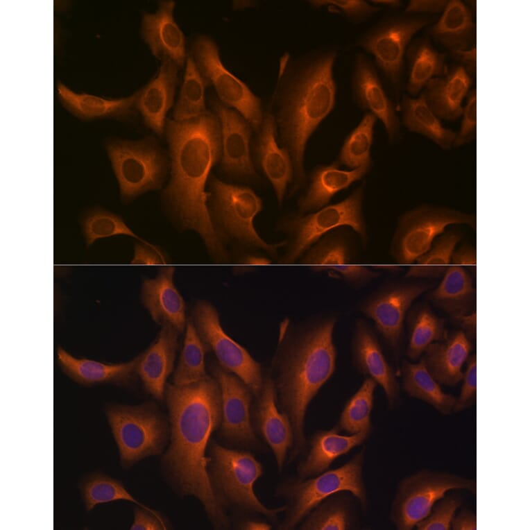 Immunofluorescence - Anti-HSP70 Antibody (A306410) - Antibodies.com