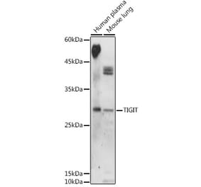 Western Blot - Anti-TIGIT Antibody (A306412) - Antibodies.com