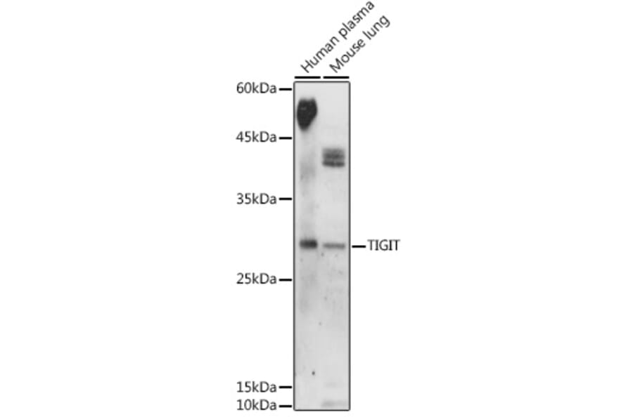 Western Blot - Anti-TIGIT Antibody (A306412) - Antibodies.com