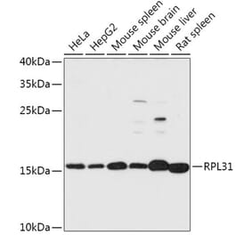 Western Blot - Anti-RPL31 Antibody (A306413) - Antibodies.com