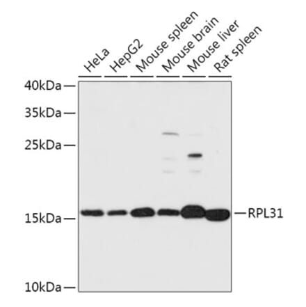 Western Blot - Anti-RPL31 Antibody (A306413) - Antibodies.com