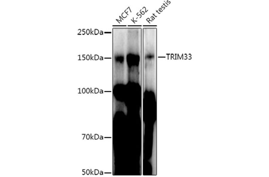Western Blot - Anti-TRIM33 Antibody (A306414) - Antibodies.com