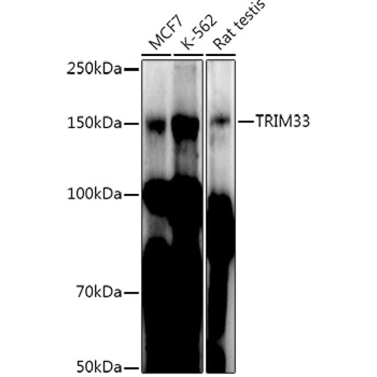 Western Blot - Anti-TRIM33 Antibody (A306414) - Antibodies.com