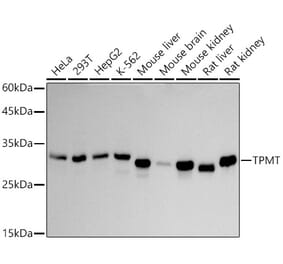 Western Blot - Anti-TPMT Antibody [ARC2897] (A306415) - Antibodies.com