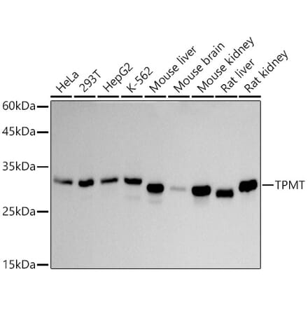 Western Blot - Anti-TPMT Antibody [ARC2897] (A306415) - Antibodies.com