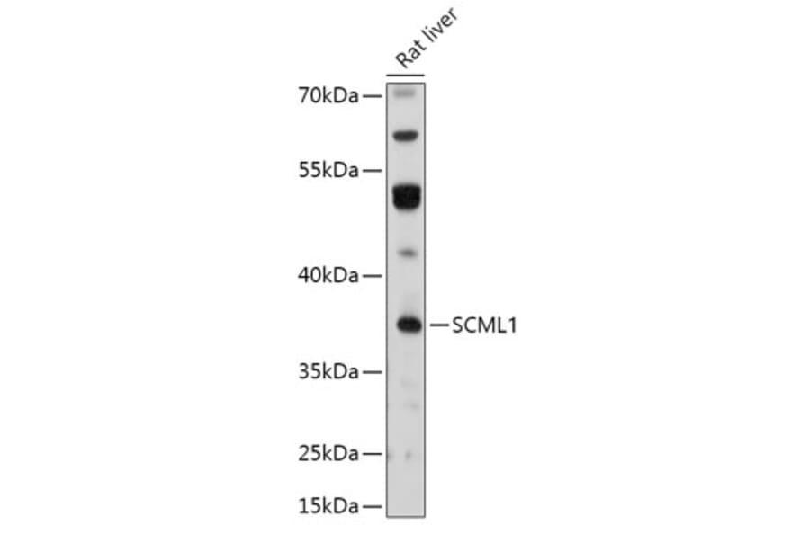Western Blot - Anti-SCML1 Antibody (A306416) - Antibodies.com