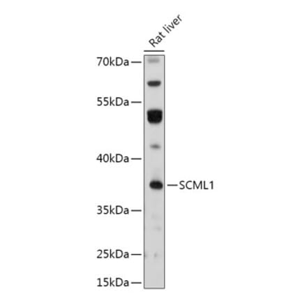 Western Blot - Anti-SCML1 Antibody (A306416) - Antibodies.com