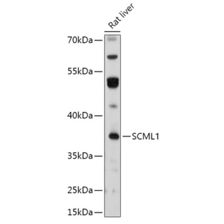 Western Blot - Anti-SCML1 Antibody (A306416) - Antibodies.com