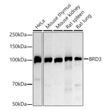 Western Blot - Anti-BRD3 Antibody (A306417) - Antibodies.com