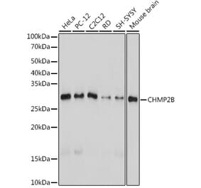 Western Blot - Anti-CHMP2B Antibody [ARC2404] (A306419) - Antibodies.com