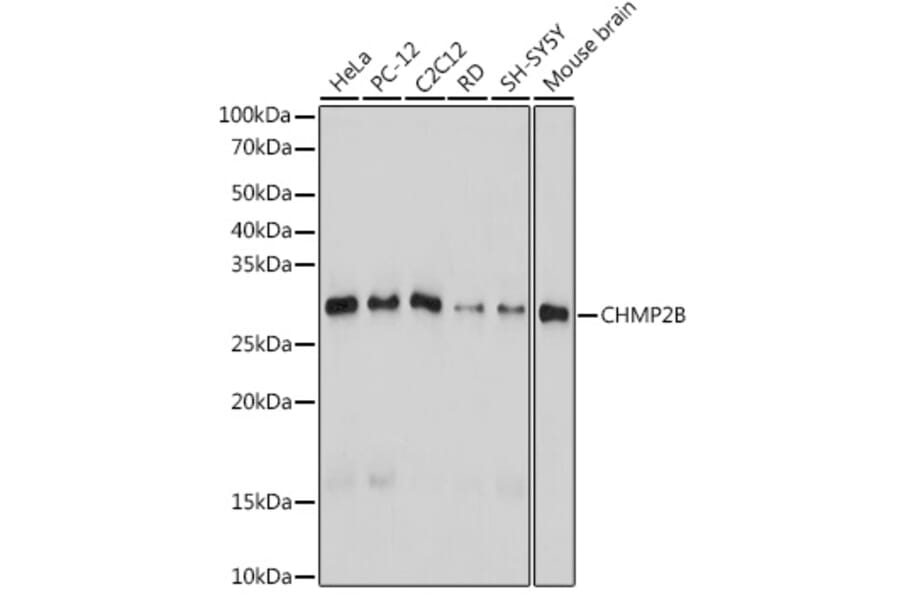 Western Blot - Anti-CHMP2B Antibody [ARC2404] (A306419) - Antibodies.com