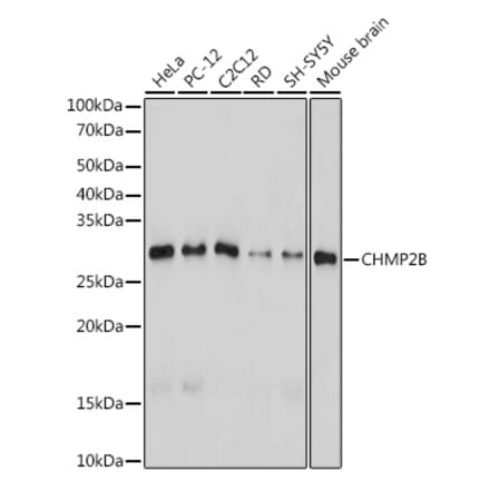 Western Blot - Anti-CHMP2B Antibody [ARC2404] (A306419) - Antibodies.com