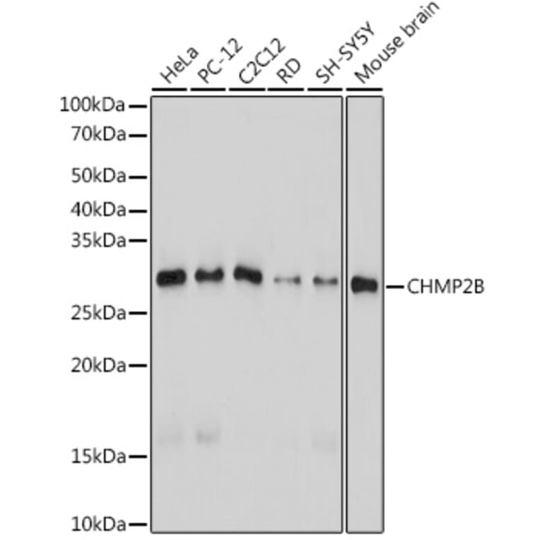 Western Blot - Anti-CHMP2B Antibody [ARC2404] (A306419) - Antibodies.com