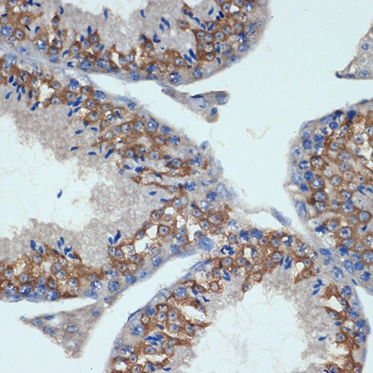 Immunohistochemistry - Anti-CHMP2B Antibody [ARC2404] (A306419) - Antibodies.com