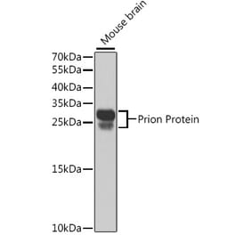 Western Blot - Anti-Prion protein PrP Antibody (A306421) - Antibodies.com