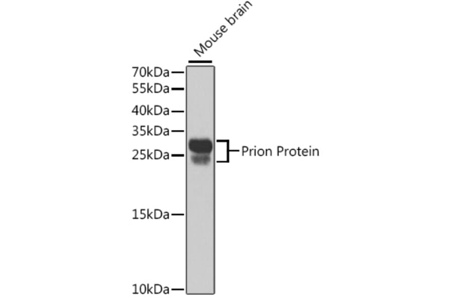 Western Blot - Anti-Prion protein PrP Antibody (A306421) - Antibodies.com