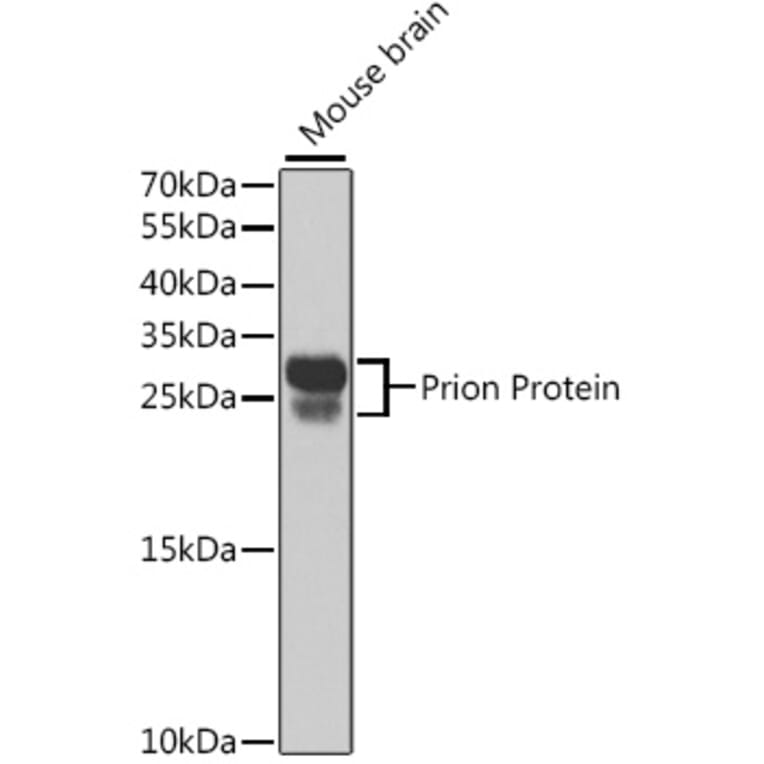Western Blot - Anti-Prion protein PrP Antibody (A306421) - Antibodies.com