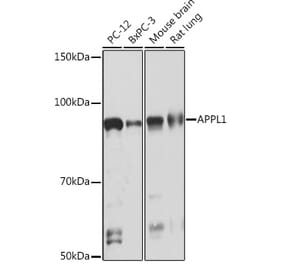 Western Blot - Anti-APPL Antibody [ARC1356] (A306422) - Antibodies.com