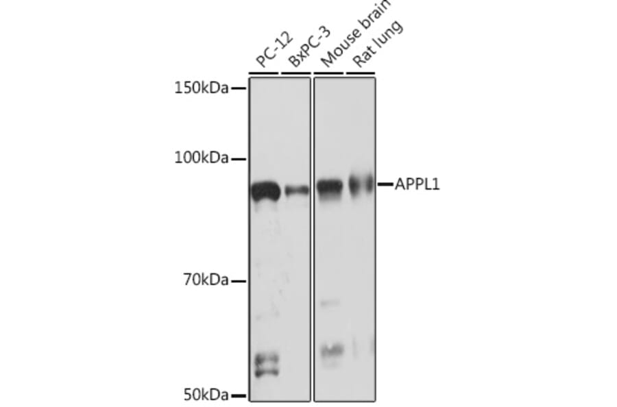 Western Blot - Anti-APPL Antibody [ARC1356] (A306422) - Antibodies.com