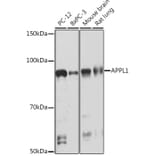 Western Blot - Anti-APPL Antibody [ARC1356] (A306422) - Antibodies.com
