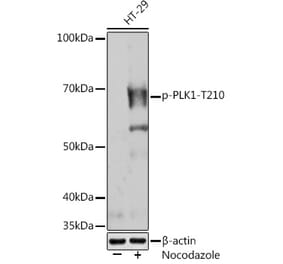 Western Blot - Anti-PLK1 (phospho Thr210) Antibody [ARC1570] (A306423) - Antibodies.com