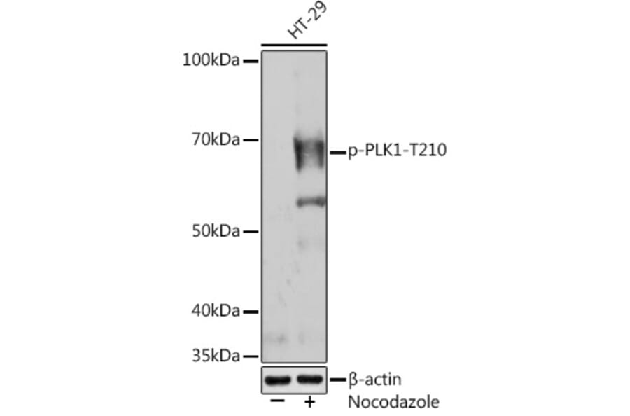 Western Blot - Anti-PLK1 (phospho Thr210) Antibody [ARC1570] (A306423) - Antibodies.com