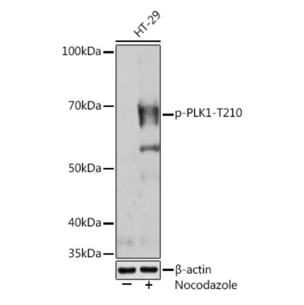Western Blot - Anti-PLK1 (phospho Thr210) Antibody [ARC1570] (A306423) - Antibodies.com