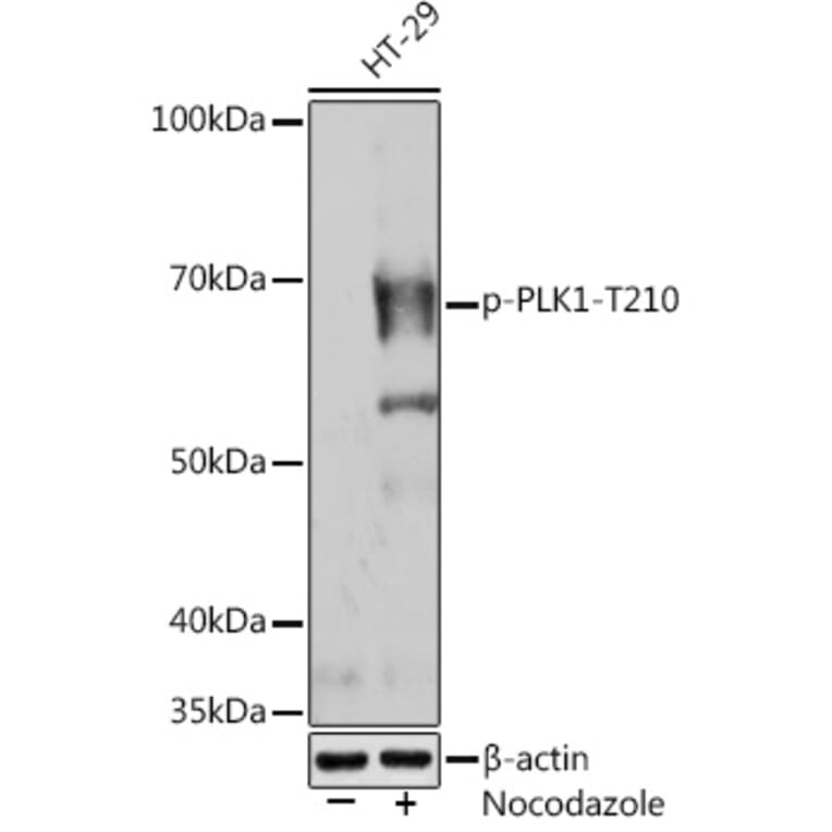Western Blot - Anti-PLK1 (phospho Thr210) Antibody [ARC1570] (A306423) - Antibodies.com