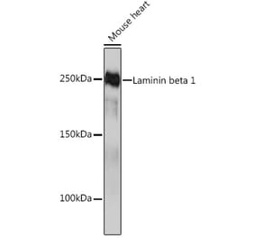 Western Blot - Anti-Laminin beta 1 Antibody [ARC0985] (A306424) - Antibodies.com