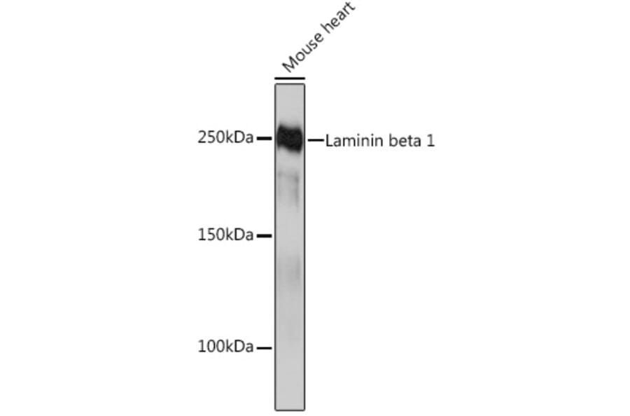 Western Blot - Anti-Laminin beta 1 Antibody [ARC0985] (A306424) - Antibodies.com