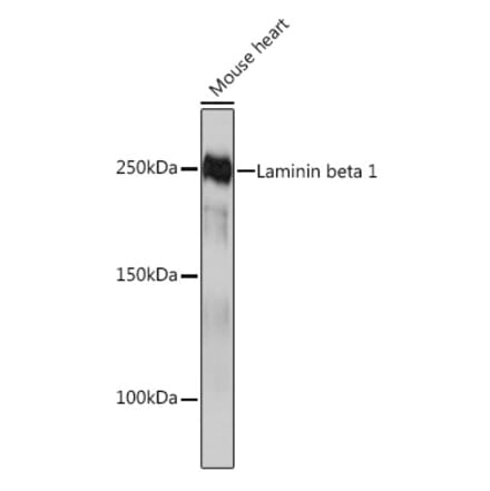 Western Blot - Anti-Laminin beta 1 Antibody [ARC0985] (A306424) - Antibodies.com