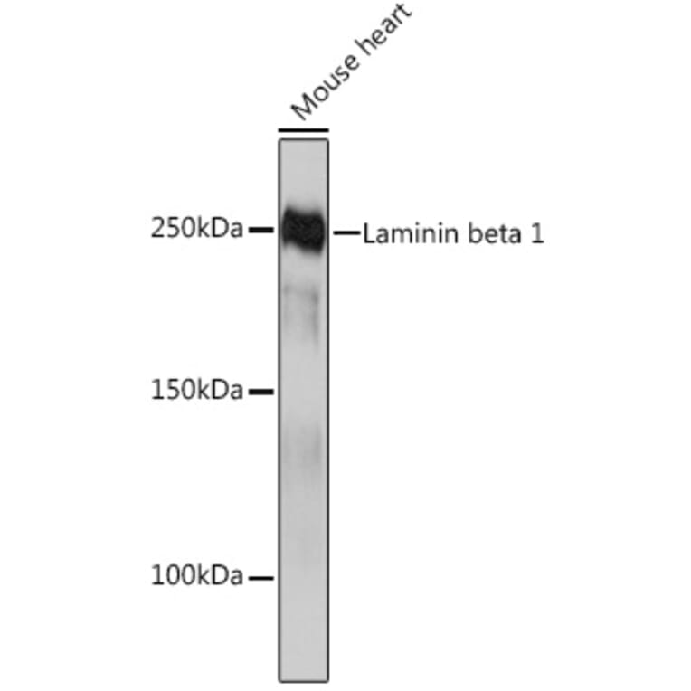 Western Blot - Anti-Laminin beta 1 Antibody [ARC0985] (A306424) - Antibodies.com