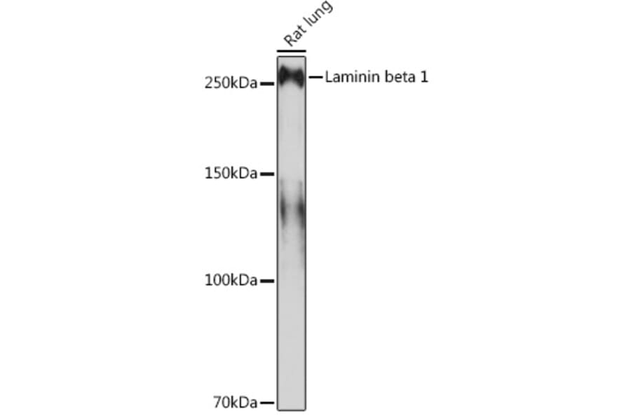 Western Blot - Anti-Laminin beta 1 Antibody [ARC0985] (A306424) - Antibodies.com