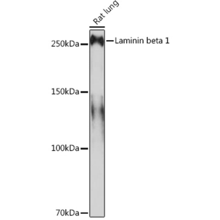 Western Blot - Anti-Laminin beta 1 Antibody [ARC0985] (A306424) - Antibodies.com