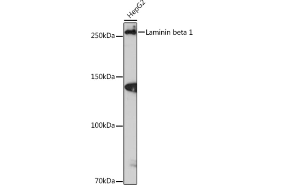 Western Blot - Anti-Laminin beta 1 Antibody [ARC0985] (A306424) - Antibodies.com