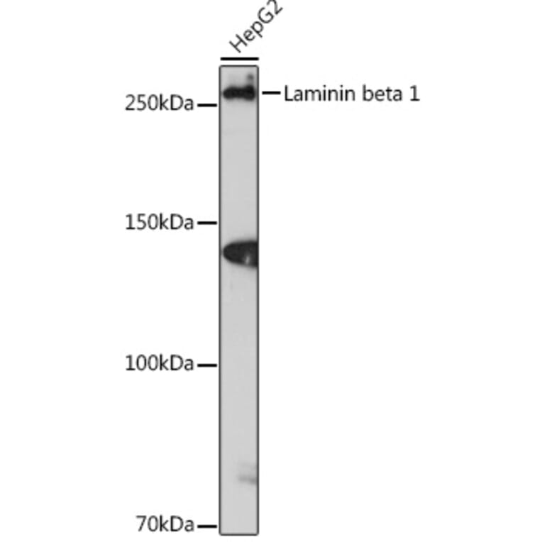 Western Blot - Anti-Laminin beta 1 Antibody [ARC0985] (A306424) - Antibodies.com