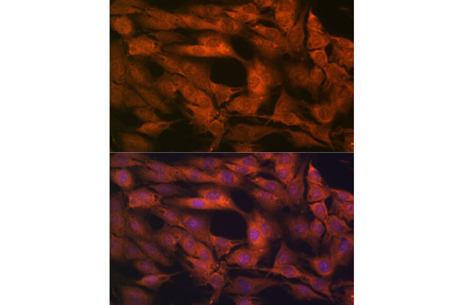 Immunofluorescence - Anti-Laminin beta 1 Antibody [ARC0985] (A306424) - Antibodies.com