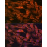 Immunofluorescence - Anti-Laminin beta 1 Antibody [ARC0985] (A306424) - Antibodies.com