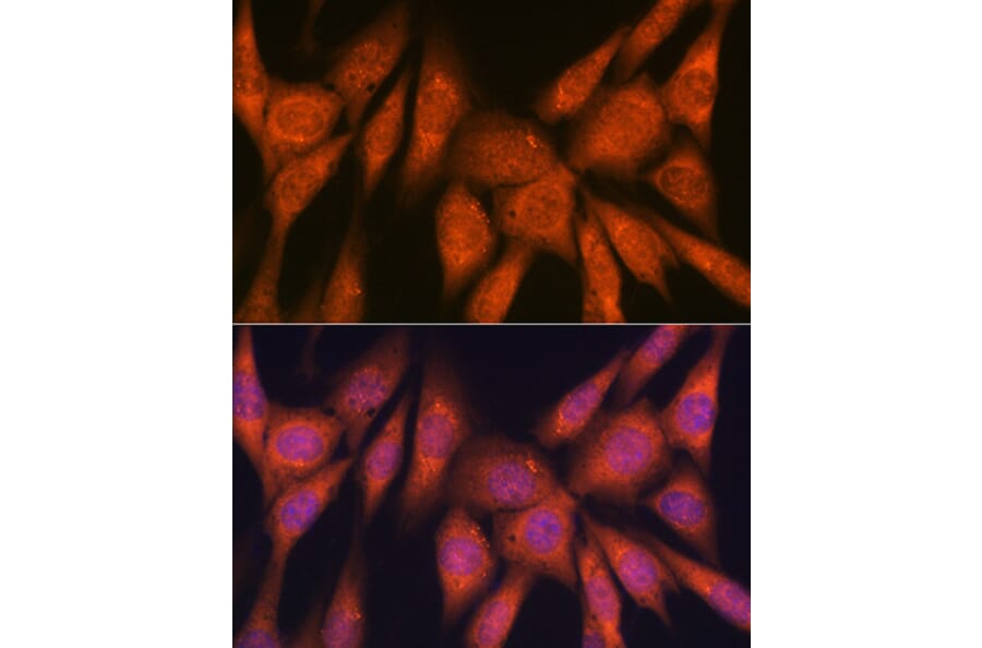 Immunofluorescence - Anti-Laminin beta 1 Antibody [ARC0985] (A306424) - Antibodies.com