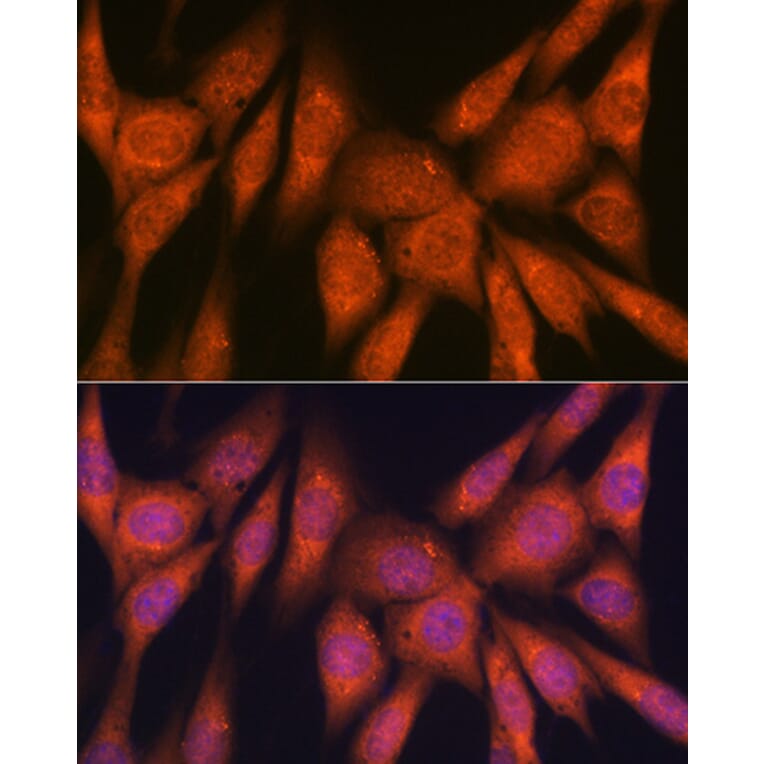 Immunofluorescence - Anti-Laminin beta 1 Antibody [ARC0985] (A306424) - Antibodies.com