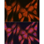 Immunofluorescence - Anti-Laminin beta 1 Antibody [ARC0985] (A306424) - Antibodies.com